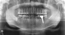 %_tempFileNameImplant%2044j6%