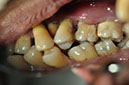 %_tempFileNameImplant%2045a3%