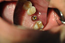 %_tempFileNameImplant%2048f6%