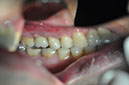 %_tempFileNameImplant%2048g2%