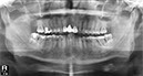 %_tempFileNameImplant%2048i1%
