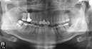 %_tempFileNameImplant%2048i4%