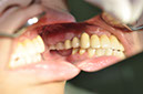 %_tempFileNameImplant%2053e3%