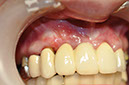 %_tempFileNameImplant%2055d2%