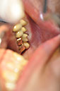%_tempFileNameImplant%2058d2%
