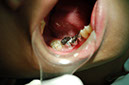 %_tempFileNameImplant%205a%
