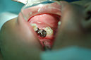 %_tempFileNameImplant%205b%