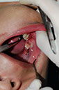 %_tempFileNameImplant%205e%