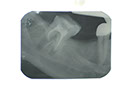 %_tempFileNameImplant%205p%