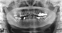 %_tempFileNameImplant%2065d1%