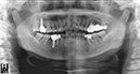 %_tempFileNameImplant%2065d2%