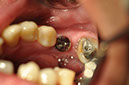 %_tempFileNameImplant%2075b2%