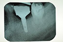 %_tempFileNameImplant%2075c3%