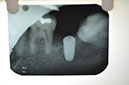 %_tempFileNameImplant%2076b2%
