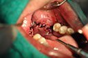 %_tempFileNameImplant%2079b9%20%