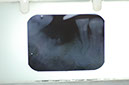 %_tempFileNameImplant%207b1%