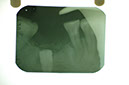 %_tempFileNameImplant%207b2%