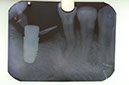 %_tempFileNameImplant%207b5%
