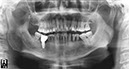 %_tempFileNameImplant%207c1%