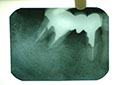 %_tempFileNameImplant%208j3%