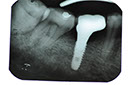 %_tempFileNameImplant%2091c3%