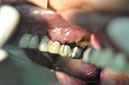%_tempFileNameImplant%2092Ua2%