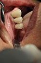 %_tempFileNameImplant%2092Uc1%