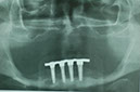%_tempFileNameImplant%2092c3%20(1)%