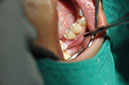 %_tempFileNameImplant%2093a1%