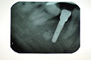 %_tempFileNameImplant%2093e3%