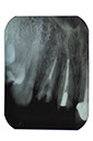 %_tempFileNameImplant%2095a4%
