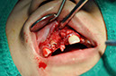 %_tempFileNameImplant%2095b1%