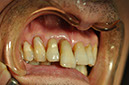 %_tempFileNameImplant%2096a1%