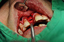%_tempFileNameImplant%2096a5%