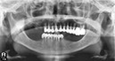 %_tempFileNameImplant%2098d1%