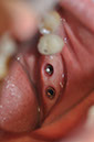 %_tempFileNameImplant%2099c5%