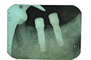 %_tempFileNameImplant%2099d1%
