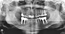 %_tempFileNameImplant%2099d3%