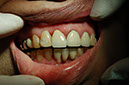 %_tempFileNameImplant%209j1%
