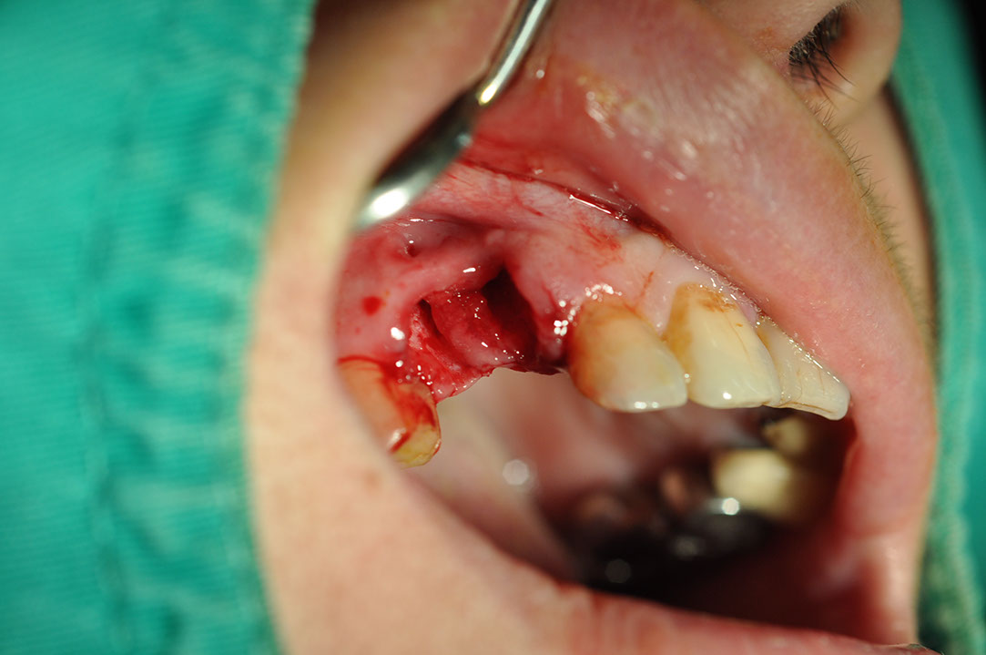 %_tempFileNameImplant%20120a3-1%