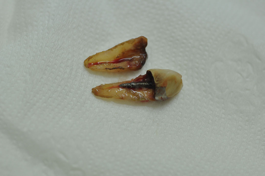 %_tempFileNameImplant%20120a3%