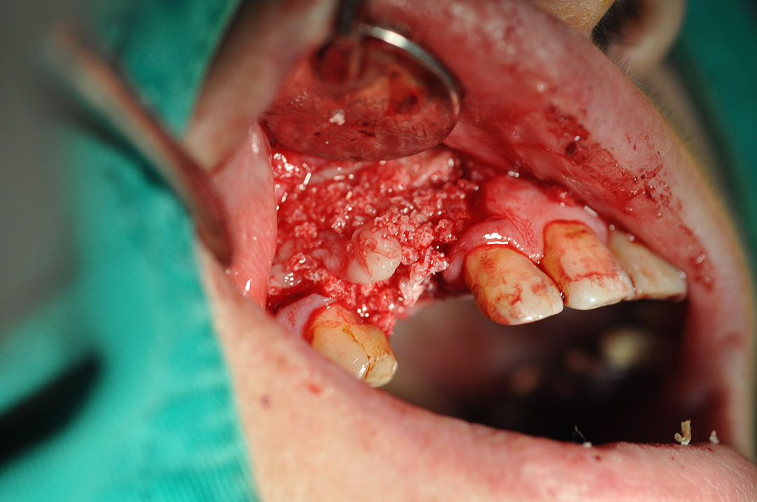 %_tempFileNameImplant%20120b5%