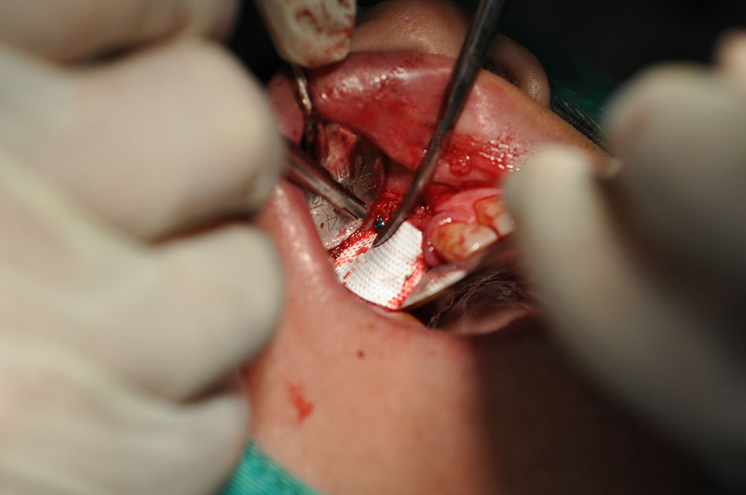 %_tempFileNameImplant%20120b6%