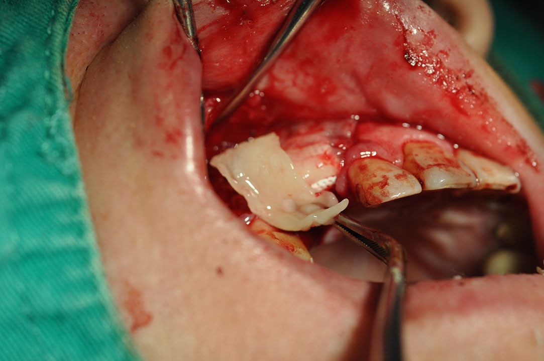 %_tempFileNameImplant%20120b7%
