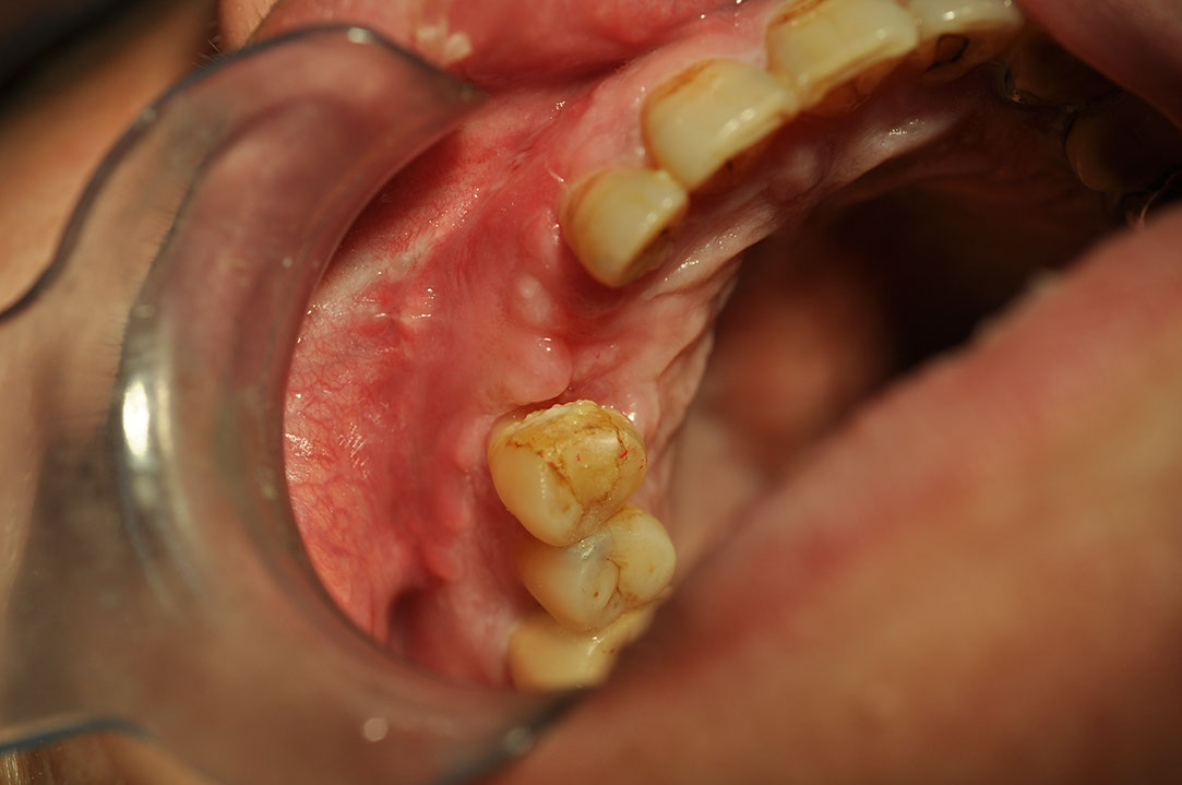 %_tempFileNameImplant%20120b8%