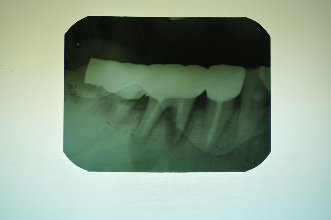 %_tempFileNameImplant%20123a2%