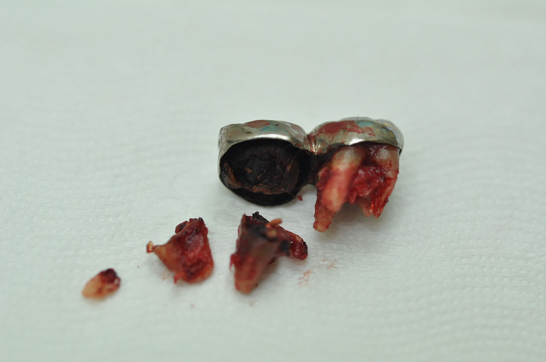 %_tempFileNameImplant%20123a3%