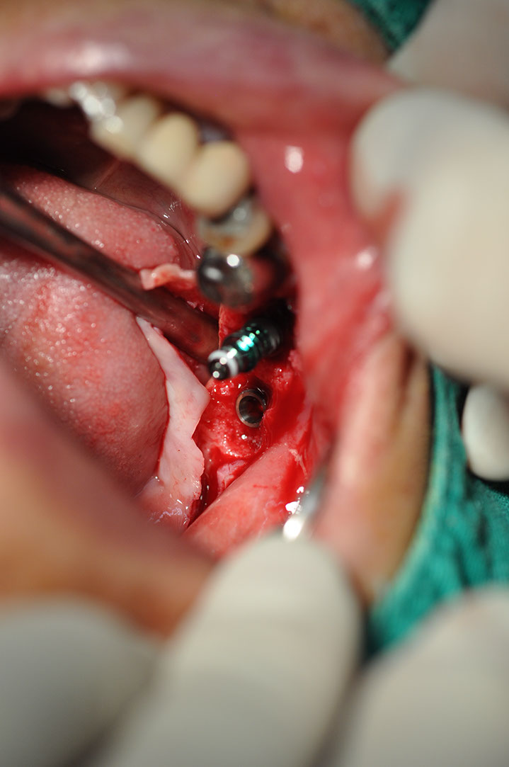 %_tempFileNameImplant%20123a7%