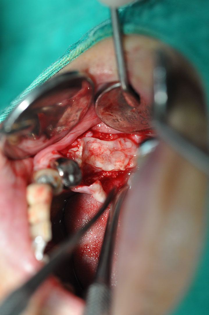 %_tempFileNameImplant%20123b4%