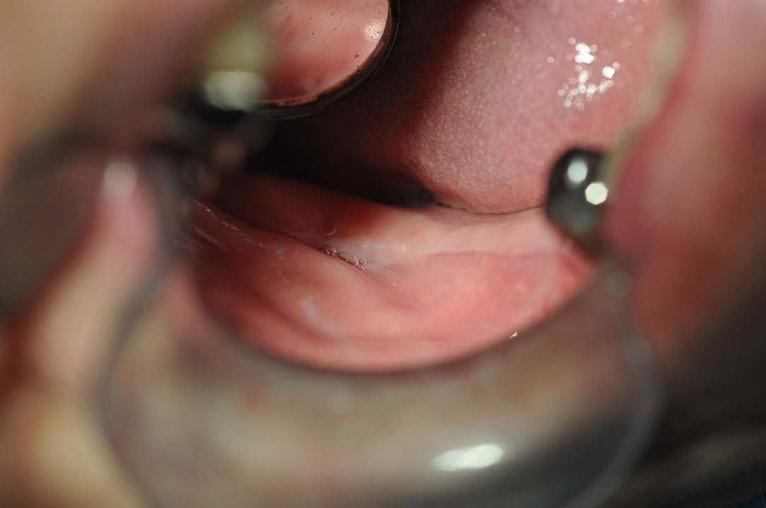 %_tempFileNameImplant%20123b7%